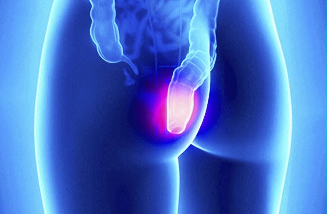 Gelarex kan zowel uitwendig als rectaal worden gebruikt